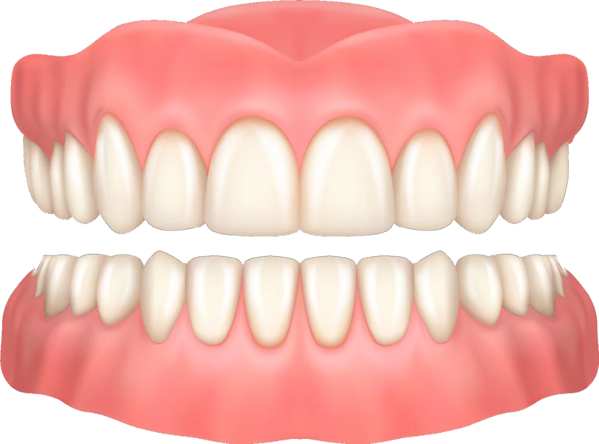 A full upper and lower set of replacement dentures